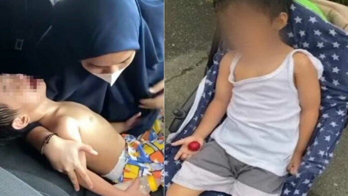 Viral Kasus Bocah 4 Tahun di Banjarmasin Dianiaya Guru PAUD, Tangannya Patah