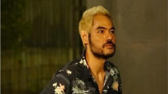 Artis Yogi Gamblez Positif Narkoba, Seret Aktor Epy Kusnandar