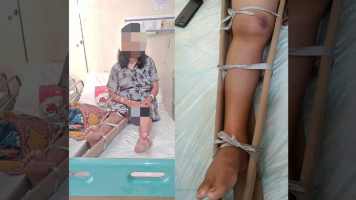 Warga Cihaurbeuti Ciamis Jadi Korban Gigitan Ular Berbisa Tinggi