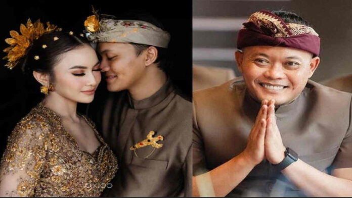 Dukungan Sule Untuk Mahalini yang Tuai Hujatan Usai Oplas