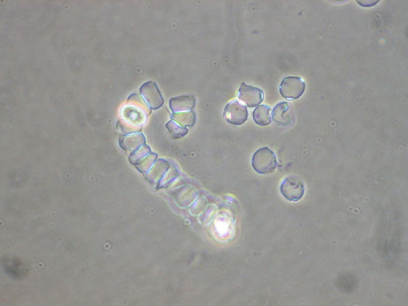 Protista Mirip Jamur Lengkap dengan Ciri dan Klasifikasinya