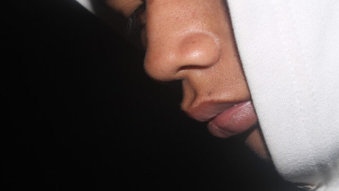 Fungsi Rambut Pada Hidung, Bisa Membuat Udara Lebih Lembab