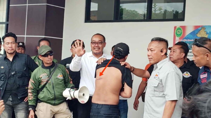 Keluarga Terdakwa Kasus Pembacokan di Tasikmalaya Yakin Polisi Salah Tangkap