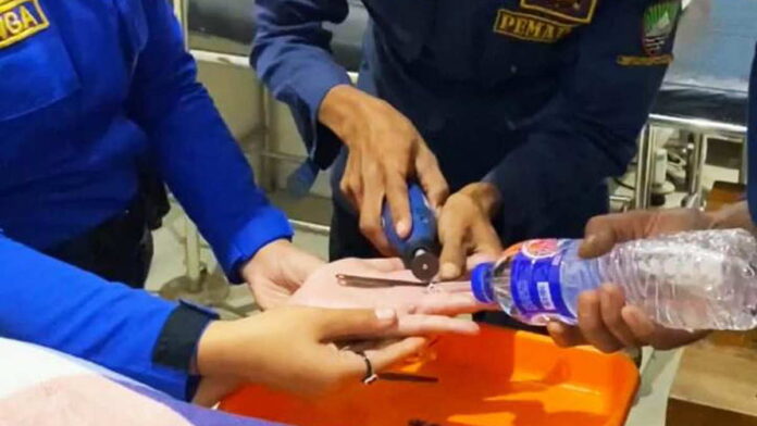 Damkar Sumedang Bantu Lepaskan Cincin Ibu yang Hendak Melahirkan