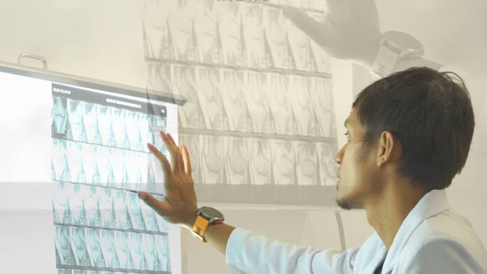 Hari Kanker Tulang Nasional, Dokter RSUD Pandega Pangandaran Kenali Gejala Sejak Dini