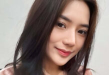 Berlliana Lovell Jalani Operasi di Korea, Alami Kista Payudara